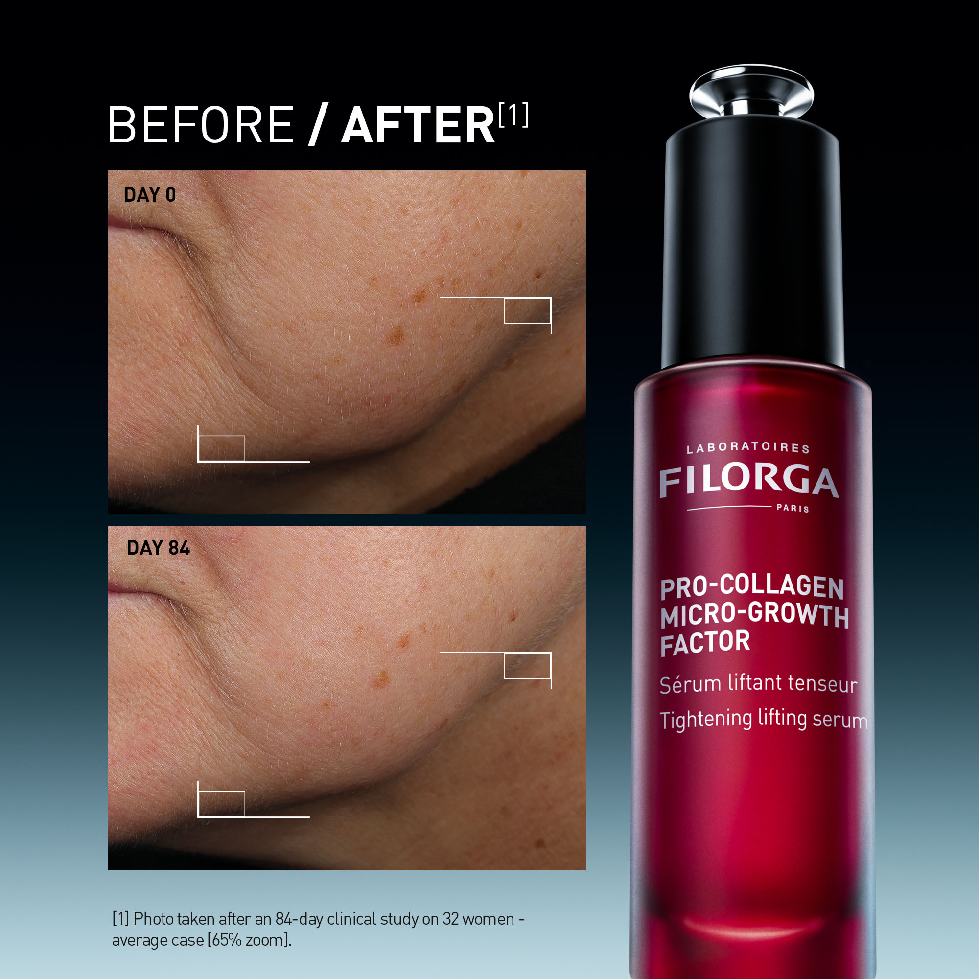 Filorga Pro-Collagen Growth Factor Serum - Tightening lifting serum (30ML) - Image 4