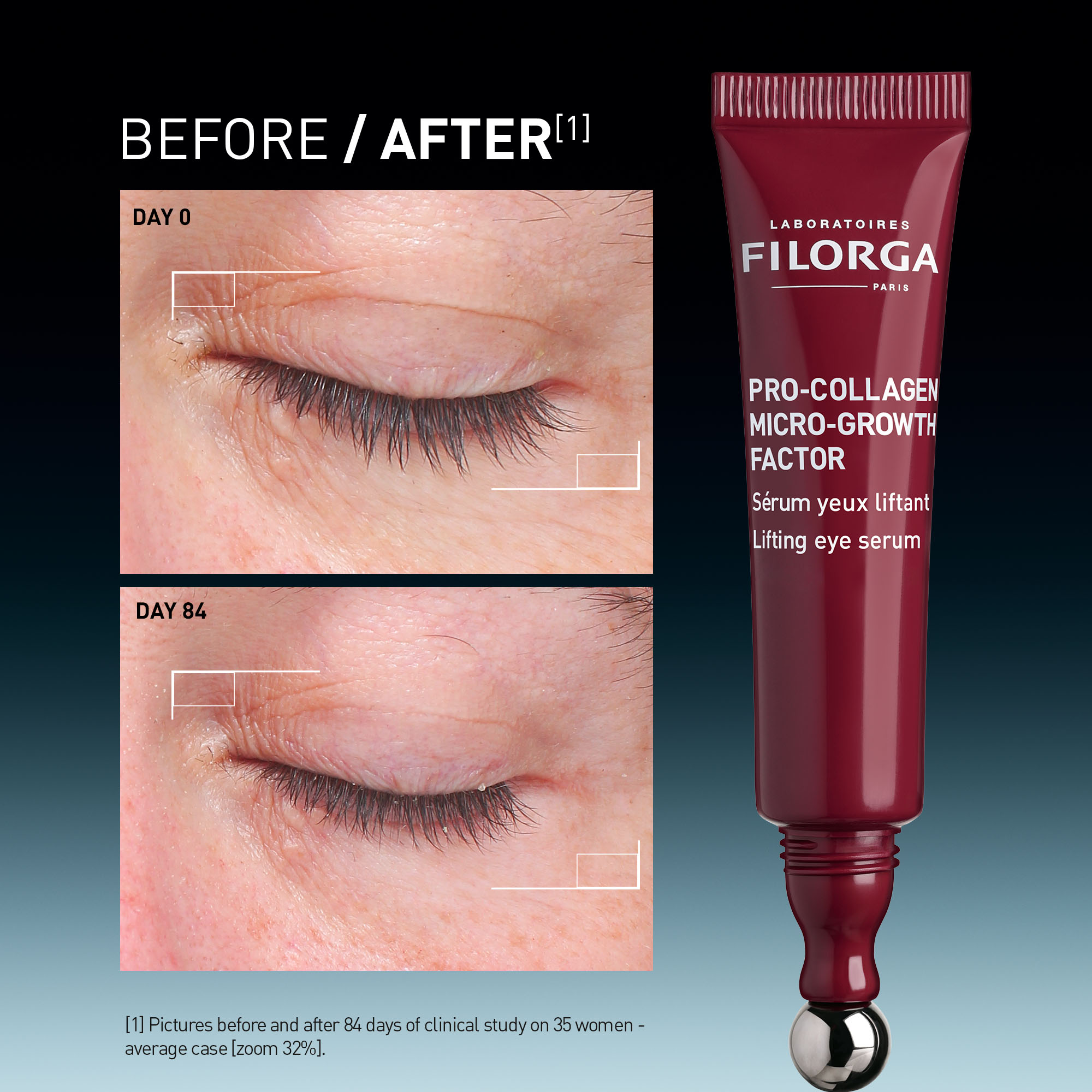 Filorga Pro-Collagen Growth Factor Eye Serum - Lifting eye serum (15ML) - Image 8